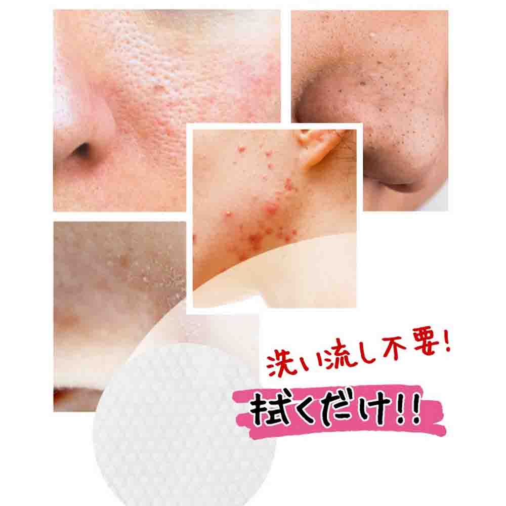 Cynet Mjcare Mild AHA+BHA+PHA Peeling Pad 70 sheets - Image 2